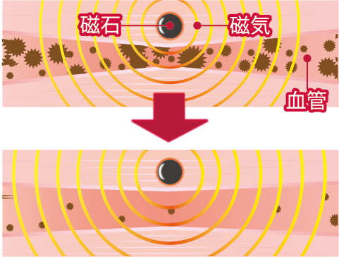 肩・背中のコリに効く